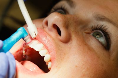 Photo of Dental Check-Up
